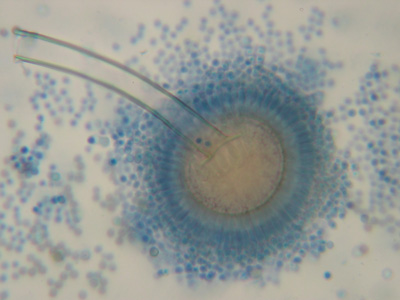 Schimmelpilz Aspergillus