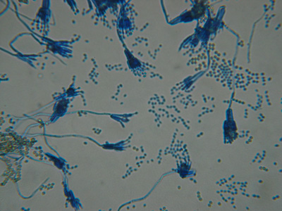 Schimmelpilz und PENICILLIUM